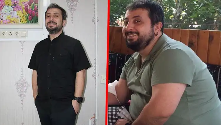 2 Yılda 40 Kilo Verdi: Mide Küçültme Ameliyatı Hakkında Yanlış Anlaşılanlar
